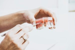 How To Find Cheap Dental Implants In 2021